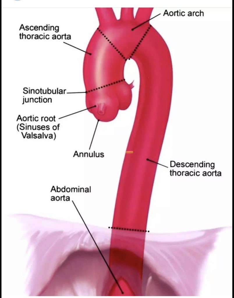 Aorta