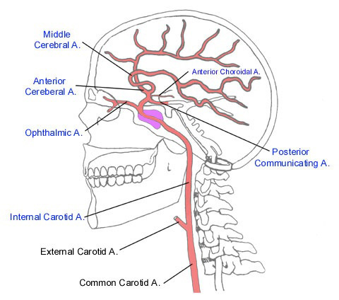 Arterial Supply To The Brain Carotid Vertebral Teachm - vrogue.co